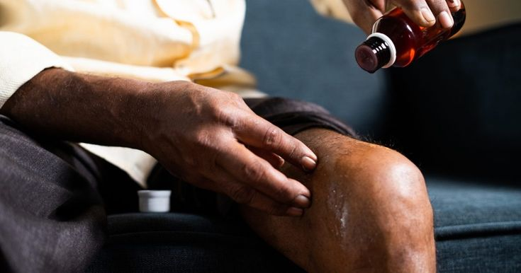 Ayurvedic Pain Management