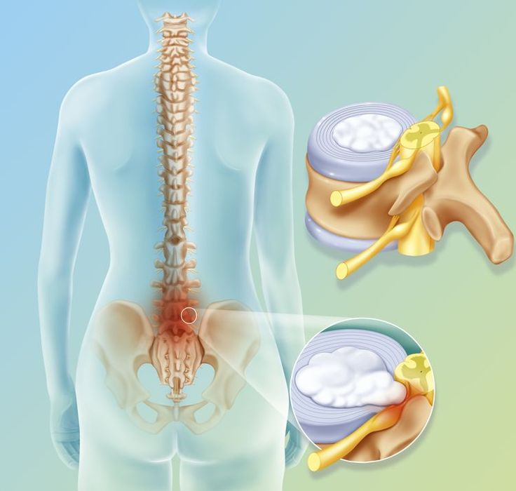 Pain, Spine & Joint