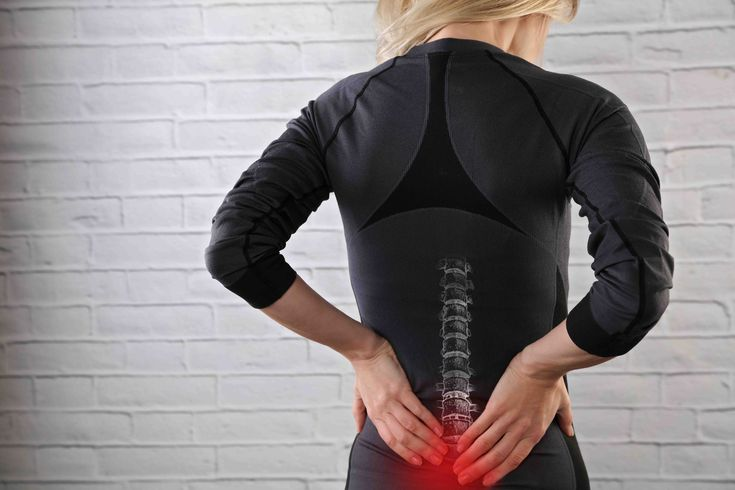 Spondylolisthesis