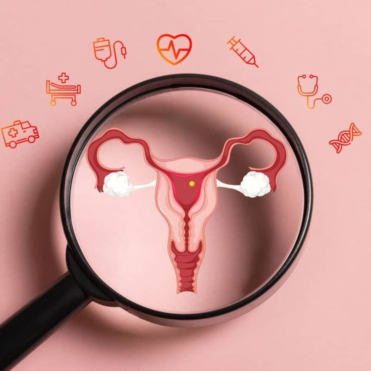 Women's Health