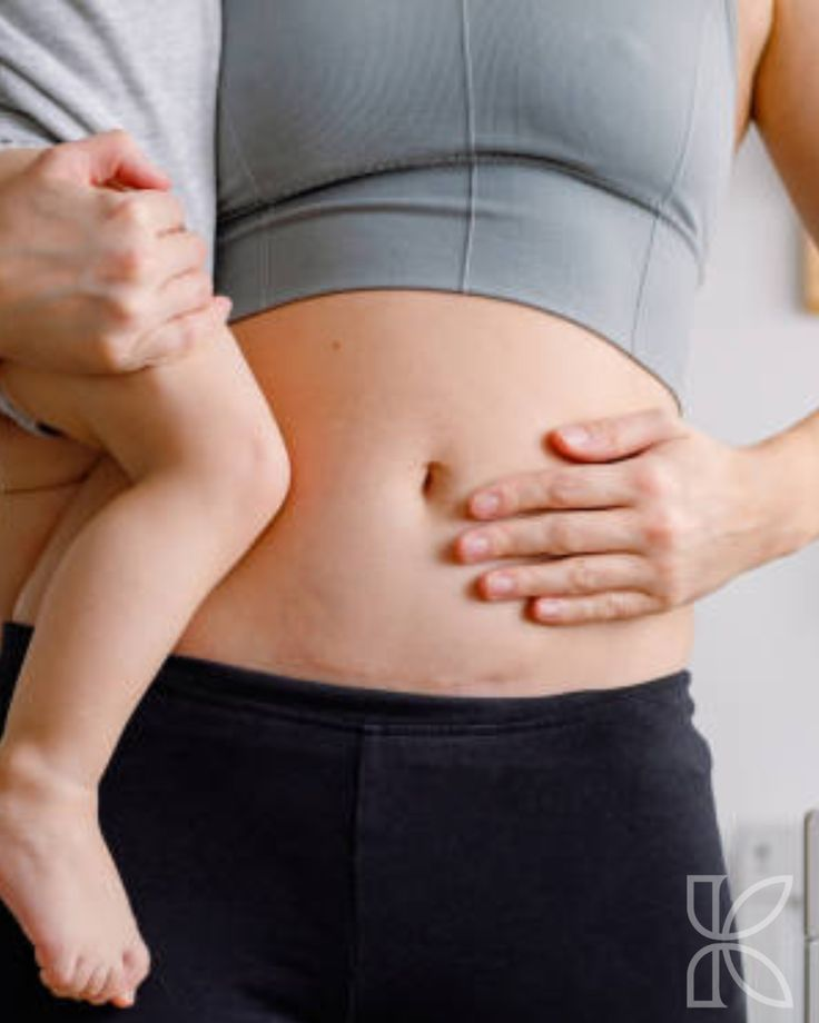 Postnatal Recovery