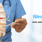 स्लिप डिस्क