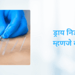 ड्राय निडलिंग म्हणजे काय